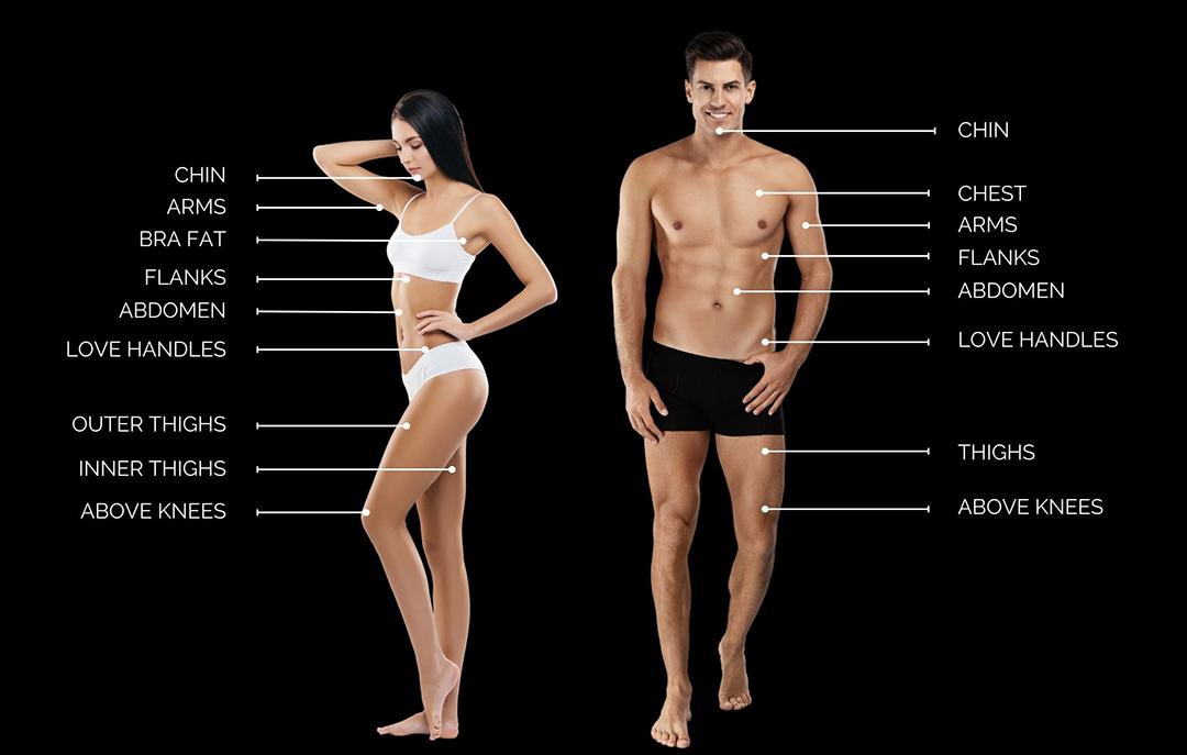 Sculpted and fit man and woman posing in underwear modeling the targeted treatment areas for Coolsculpting Elite.